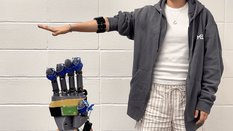 method diagram comparing conventional gesture recognition methods that assume full observability of the entire gesture before assigning a label versus our method that labels a continuous stream of EMG data that can potentially include successive transitions between different gestures as well as periods of holding a same gesture